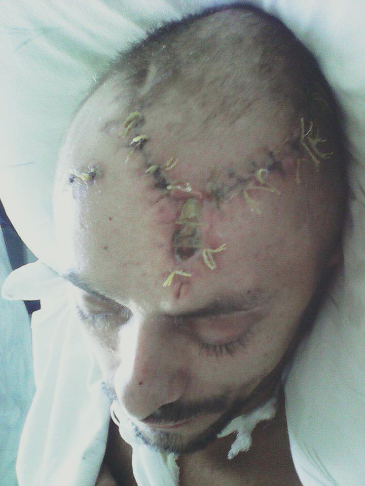 помощь лечение сергей раненые гриненко