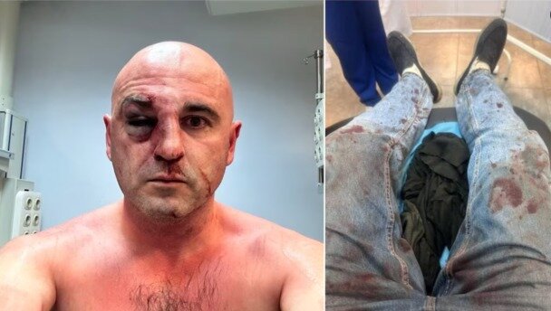 У Грузії поліція затримала понад 60 учасників протесту проти ухвалення закону про 