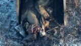 Russian man with severed leg is lying in rubbish bin