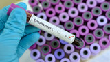 Government approves action plan to prevent coronavirus - Honcharuk