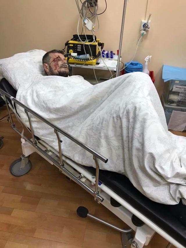 Мосийчука оперируют, у него много осколочных ранений, - Линько 01 Мосийчука оперируют, у него много осколочных ранений, - Линько 01