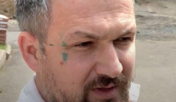 Три титушки напали на экс-нардепа Левченко, борющегося со "строительной мафией", - Лерос. ФОТО