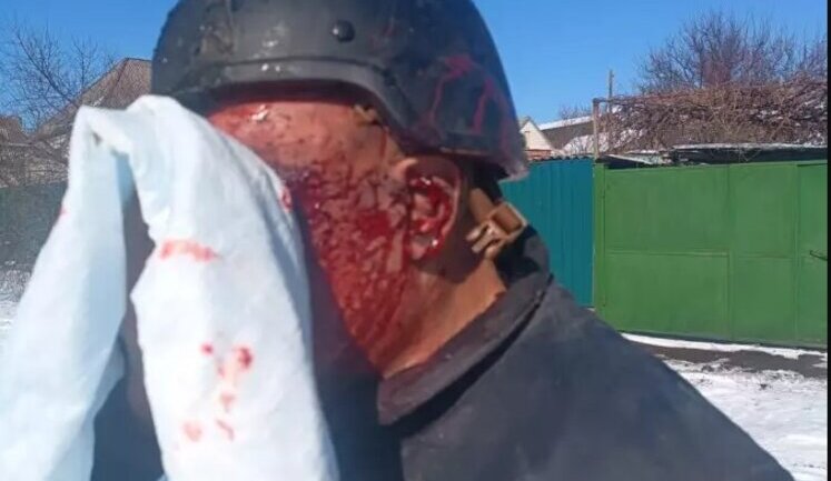 Russians attacked Kostiantynivka twice: two rescuers, two policemen and head of CMA were wounded. PHOTO (updated)