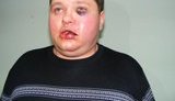 "Бей жидов!" - бандиты губернатора Тулуба и "Вовчик Тайсон" организовали кровавое нападение на митинг оппозиции в Черкассах. ФОТОрепортаж+ВИДЕО