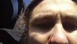 "Да какое, нах#й, лицо у тебя в крови", - охрана скандальной стройки на Осокорках избила экоактивиста Станиславского. ФОТОрепортаж