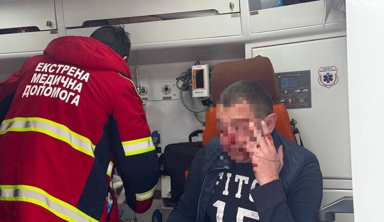 В Кривом Роге напали и избили местного журналиста: полиция разыскивает злоумышленника. ФОТОРЕПОРТАЖ