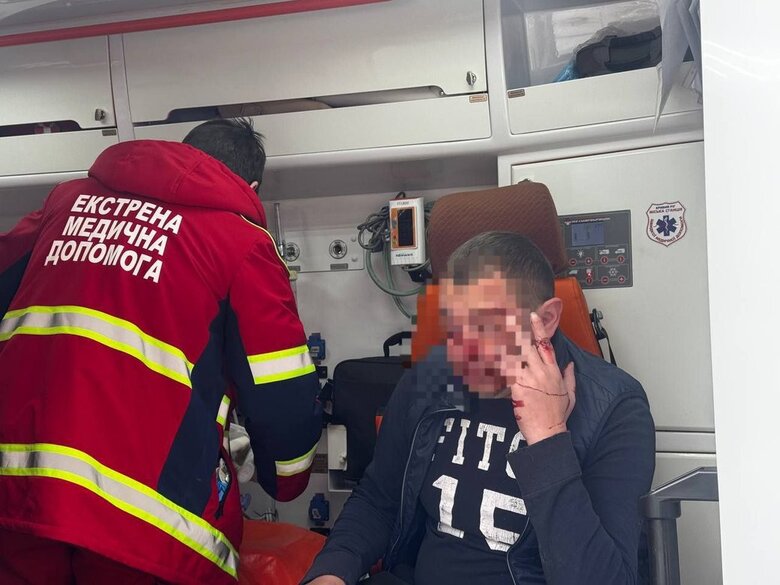 Нападение на журналиста Свои в Кривом Роге: полиция рассказала детали