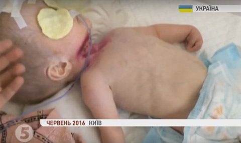 киев больница медицина сирота