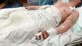 алексей раненые замирко