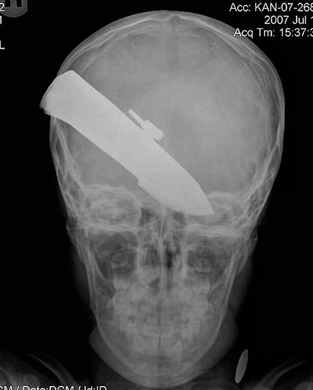 Цензор.НЕТ Изображение