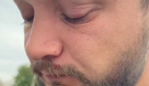 Ветеран війни заявив, що його побили військові ТЦК на Волині: терцентр показав кадри з бодікамер та все заперечив. ВIДЕО