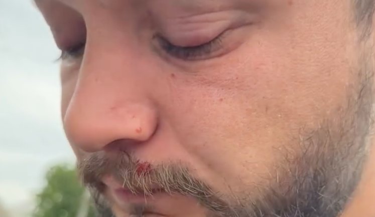 Ветеран війни заявив, що його побили військові ТЦК на Волині: терцентр показав кадри з бодікамер та все заперечив. ВIДЕО