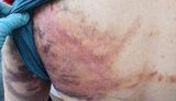 Зверства белорусского ОМОНа: жуткие кадры пыток задержанных. ФОТОрепортаж