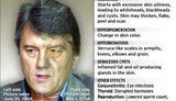 Жвания: отравление Ющенко было пищевым, а все анализы - абсолютная подделка