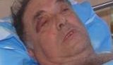 Крымский &amp;quot;Беркут&amp;quot; &amp;quot;ошибся&amp;quot;: во время ночного штурма мирного дома хозяин лишился руки, а сыну проломили голову. ВИДЕО.