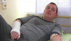 Сломана кисть и повреждено ухо, - руководителя Геокадастра Днепропетровщины Духневича избили в рабочем кабинете сотрудники управления учреждения. ФОТО