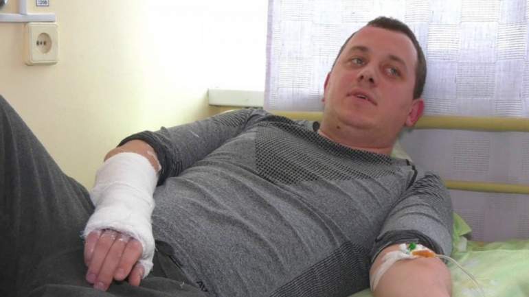 Зламана кисть та пошкоджено вухо, - керівника Геокадастру Дніпропетровщини Духневича побили у робочому кабінеті співробітники управління установи 01 Зламана кисть та пошкоджено вухо, - керівника Геокадастру Дніпропетровщини Духневича побили у робочому кабінеті співробітники управління установи 01