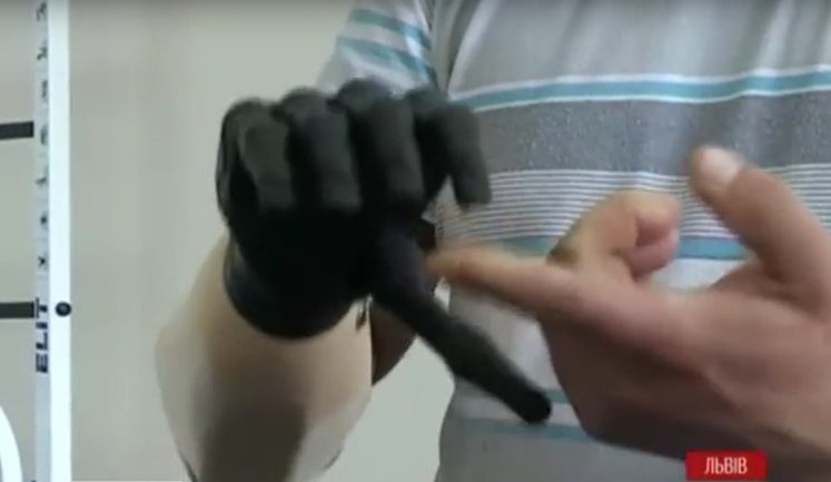Десять важкопоранених у АТО українських воїнів безплатно отримали сучасні протези. ВIДЕО