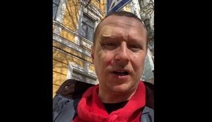 На основателя "Телевидения Торонто" Щура напал мужчина на самокате. ВИДЕО