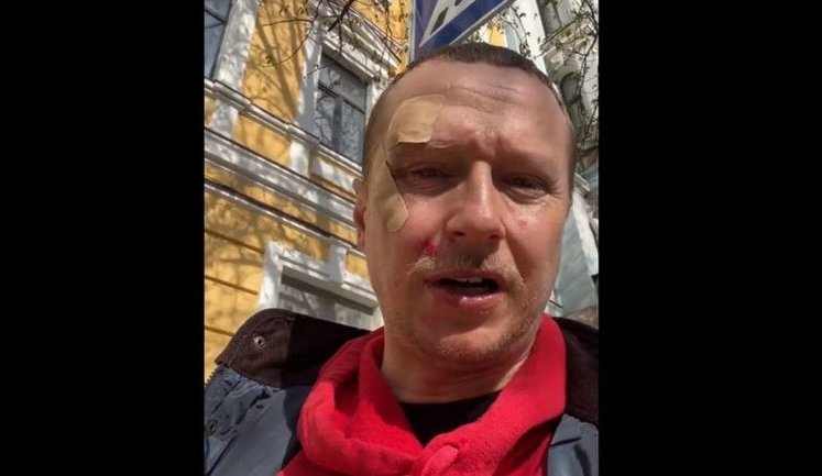 На основателя "Телевидения Торонто" Щура напал мужчина на самокате. ВИДЕО