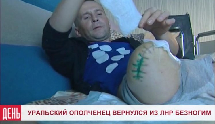 Российскому наемнику с Урала оторвало ногу в бою в Украине: "Не советую туда ехать, там очень страшно". ВИДЕО