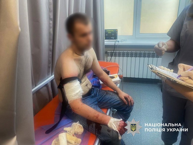 у Запоріжжі підозрюваний атакував поліцію під час обшуку