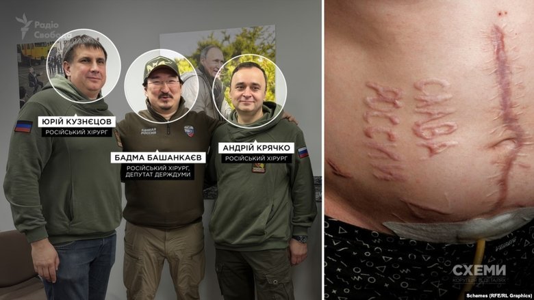 Російські хірурги з так званої групи "Друзі медицини Донбасу"