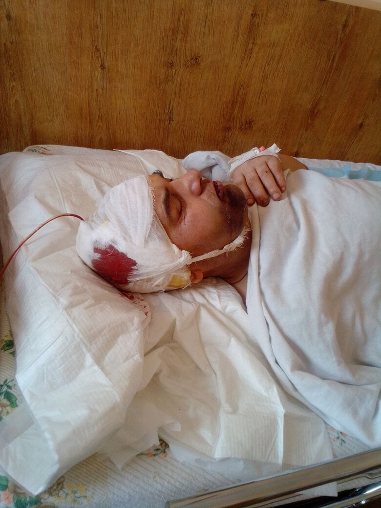 Офіцер на Волині жорстоко побив солдата. Той в лікарні: відмовили ноги 02