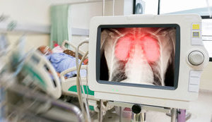 Уже більше половини українців перехворіли COVID-19, багато хто навіть не знав про це. Скоро взагалі нікому буде заражатися, - вірусолог