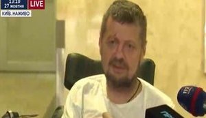 Мосийчук: Версии о том, что покушение со мной не связано - это полная дурня. ВИДЕО