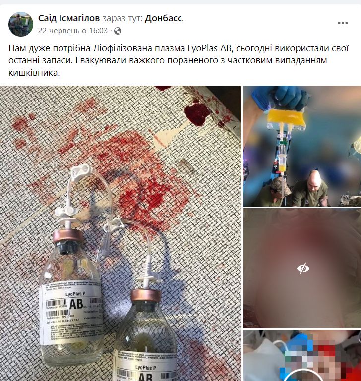 Парамедик-водій Саід Ісмагілов: Москалі, на жаль, все позаміновували. Тому під час наступу стає більше мінних травм. Солдат наступає на протипіхотну міну, відривається частина ноги… 12