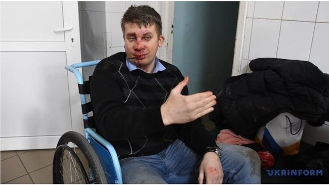 В Запорожье четверо неизвестных избили депутата облсовета Дмитрия Майстро 01