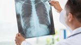 Ukraine conducts PCR tests on all patients with pneumonia
