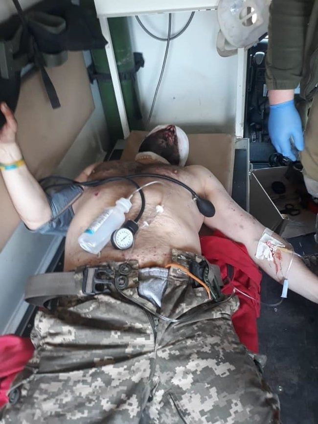 Раненым бойцам 74 ОРБ нужна помощь, - волонтер Дмитрова 03