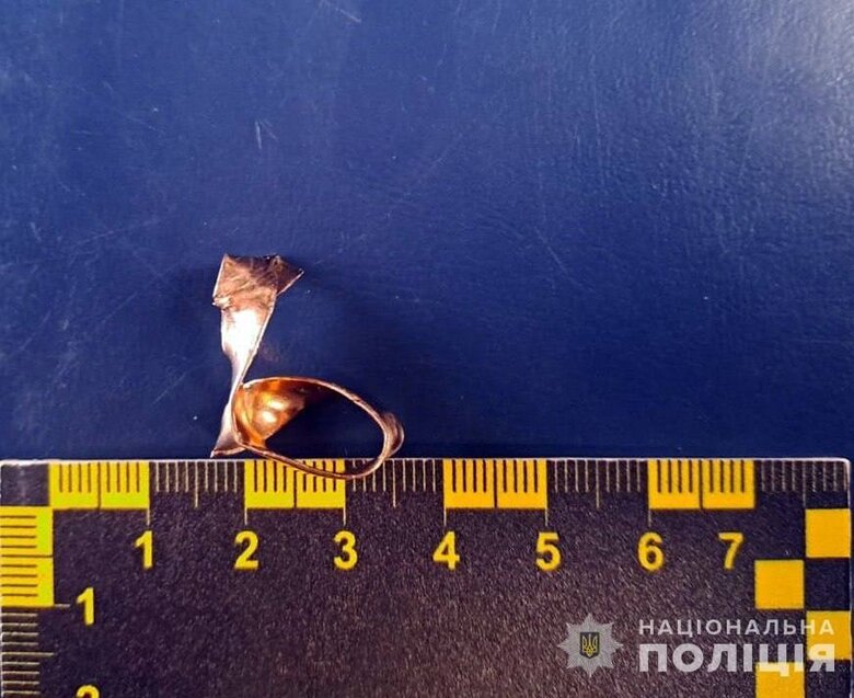 Поліція Житомирщини затримала працівника моргу, який обікрав полеглого воїна