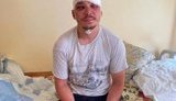 Поліція перекваліфікувала справу про напад на представника партії Шарія Роженка в Харкові з хуліганства на замах на вбивство
