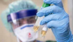 анализ,коронавирус