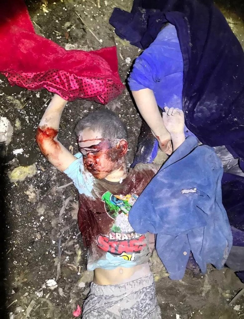 Since Russian invasion in Ukraine, 52 children died 01