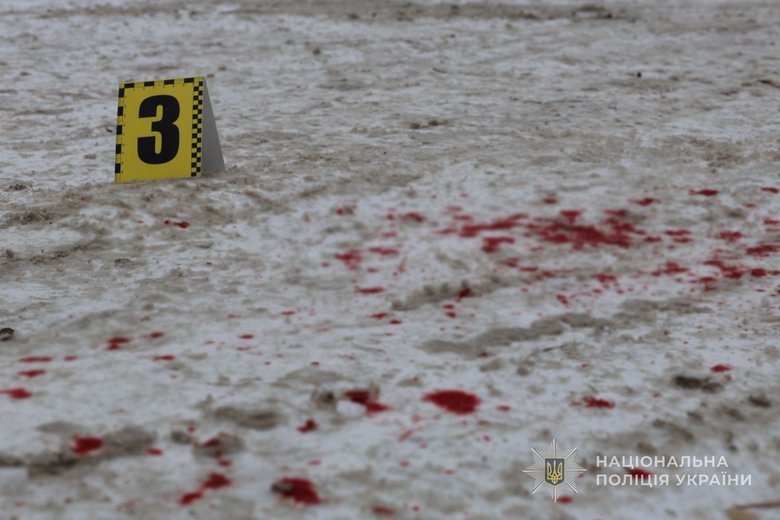Teenager shot and wounded himself in Zaporizhzhia: what is known?