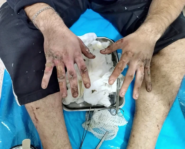 Операции ВСУ