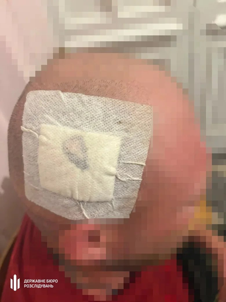 Officials from the Territorial Coordination Centre in Bukovina have been detained on suspicion of torture