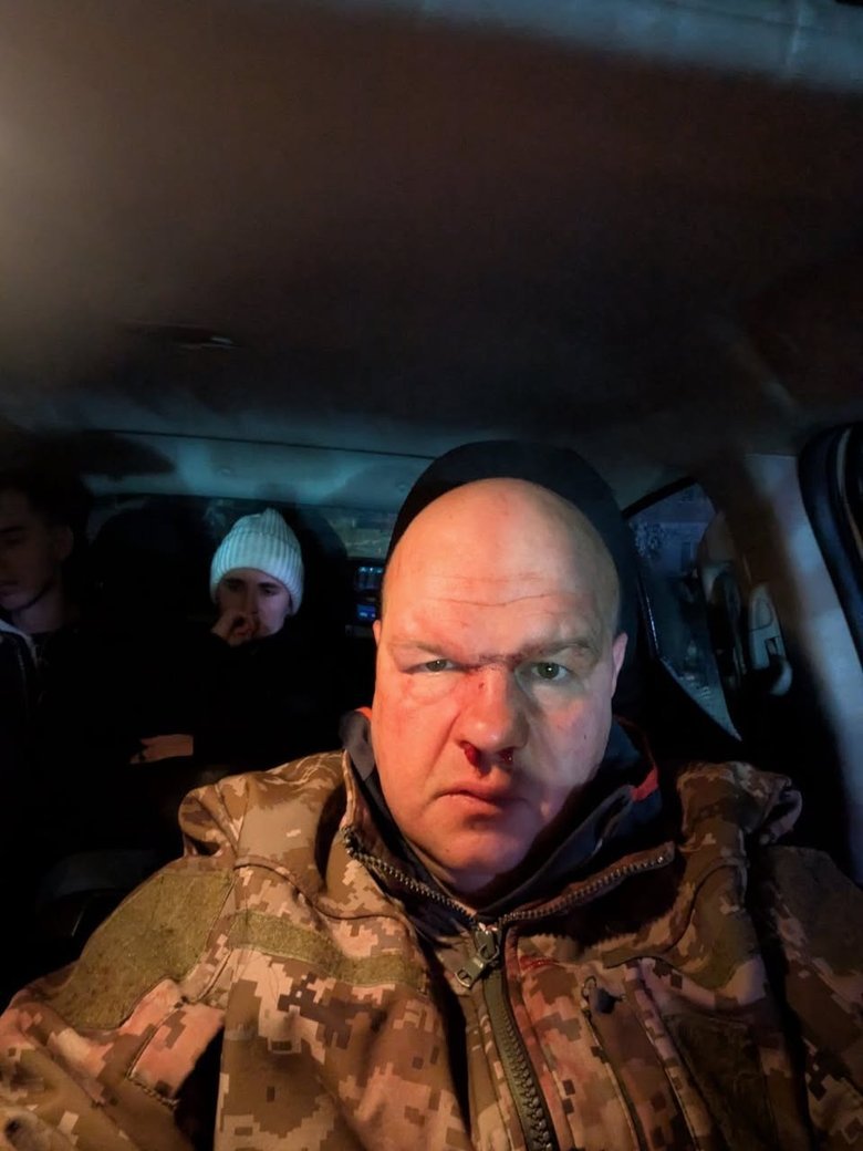 Група молодиків побила військового у місті Кременець Тернопільщини