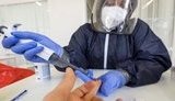 В Украине сделали рекордное количество ПЦР-тестов на COVID-19 за сутки - 8 996, - Степанов. ВИДЕО