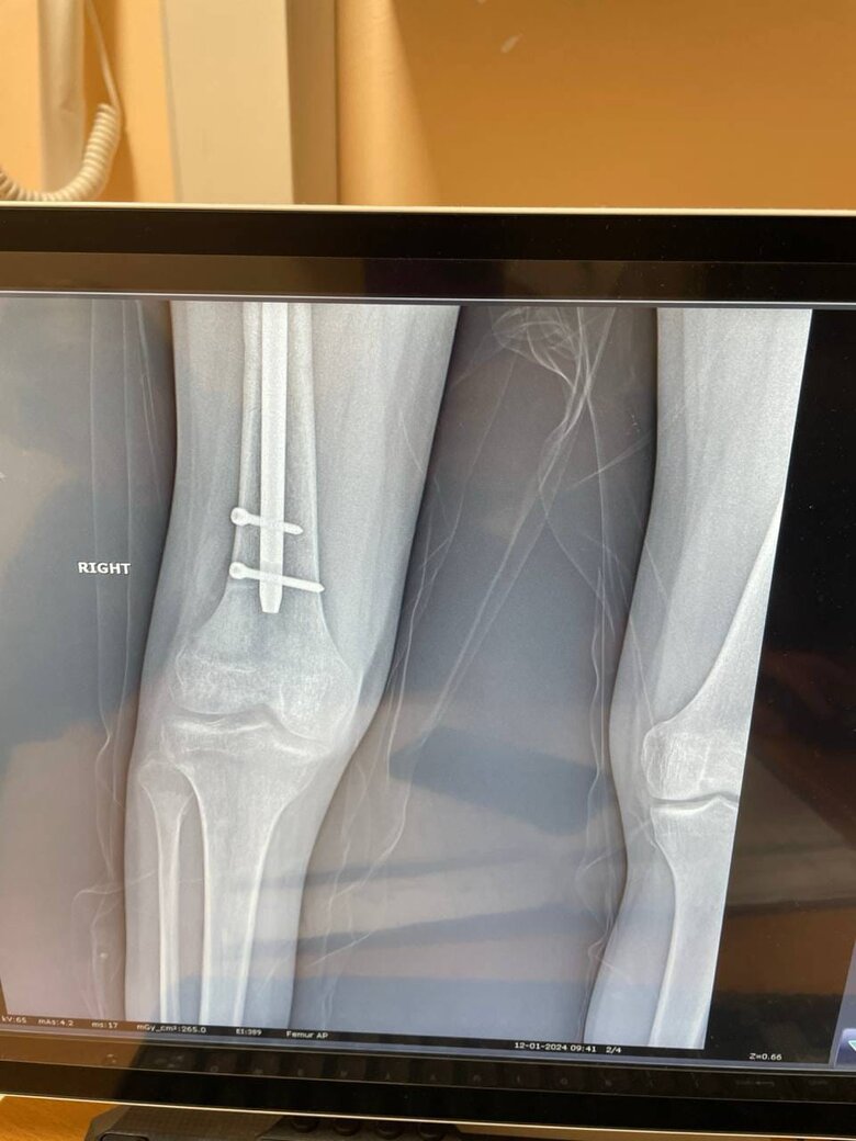 Військовий третьої штурмової бригади Алік