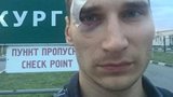 избиение журналистика
