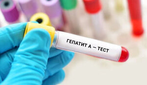 320 cases of hepatitis "A" confirmed in Vinnitsa region. INFOGRAPHICS