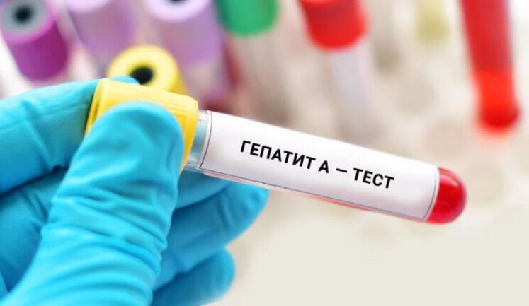 320 cases of hepatitis "A" confirmed in Vinnitsa region. INFOGRAPHICS