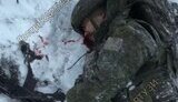 війна