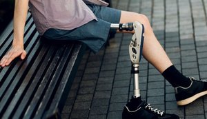 Остеоінтеграція