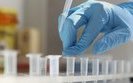 First Covid-19 case spotted in Chernihiv region